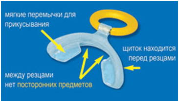 Вестибулярные пластинки — эффективные методы восстановления правильного прикуса у детей